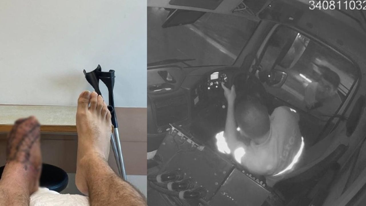 İstanbul'da belediye aracının ayağını ezdiği kişinin 5 parmağı kesildi