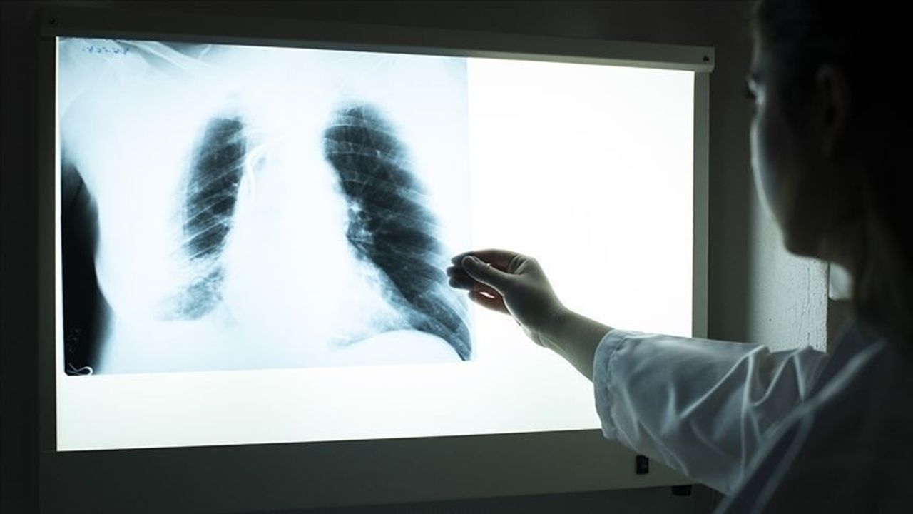 DSÖ: 2022'de 7,5 milyon kişiye tüberküloz tanısı konuldu