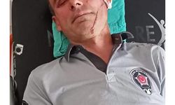 Kendisini uyaran hastane güvenliğini darp etti