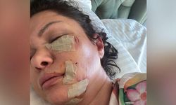 Şile'de köpek saldırısına uğrayan şarkıcı Tuğba Altıntop'un yüzüne dikiş atıldı