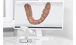 Diş ölçüsü alma işlemlerinde 3D tarayıcı dönemi