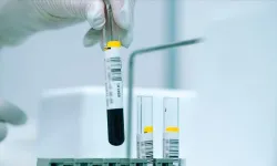 Türkiye'de nüfusun yüzde 2,1'i Akdeniz anemisi hastalığını taşıyor