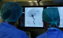 Huntington hastalığının beyindeki oluşum sürecine yönelik bulgular elde edildi