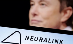 Elon Musk'ın beyin çipi firması ABD'de insan çalışması için onay aldığını söyledi
