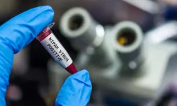 Kerala: Hindistan'da Nipah virüsü ölümlerinden sonra alarm durumunda