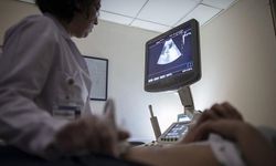 Düzensiz kanama miyom belirtisi olabiliyor