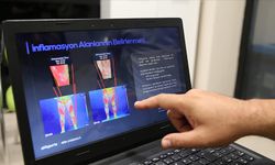 SÜ, sporcuların sakatlık risk analizini yapay zeka destekli programla yapıyor