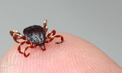 Sivas'ta KKKA hastalığı şüphesiyle tedavi gören kişi öldü