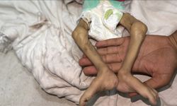 Gazze'de bir bebek daha açlıktan can verdi