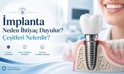 İmplanta Neden İhtiyaç Duyulur? Çeşitleri Nelerdir?