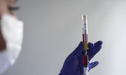 Uganda'da Ebola aşısının klinik denemelerine başlandı
