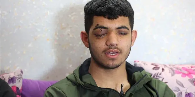 İsrail'in attığı ses bombası nedeniyle görme yetisini kaybeden Filistinli çocuk "hayallerine" tutunuyor