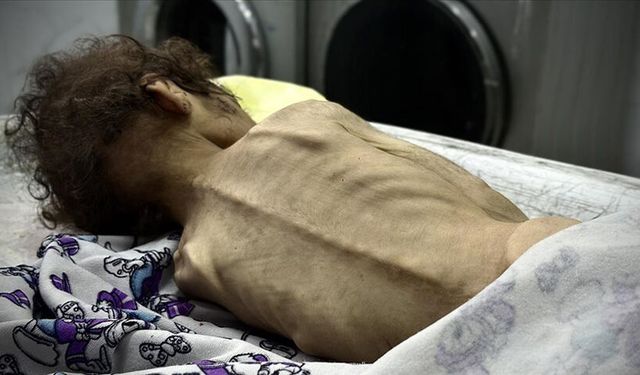 Gazze Şeridi'nde 2’si çocuk 4 kişi daha açlıktan hayatını kaybetti