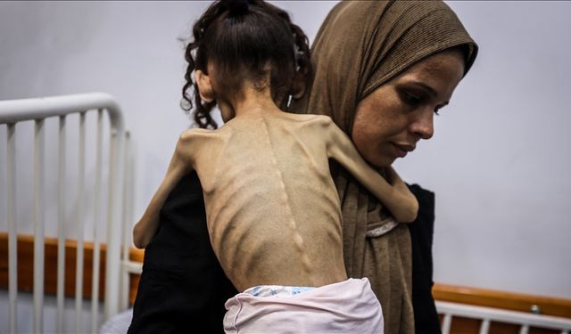 9 yaşındaki Meryem, 25 kilodan 10 kiloya düştü