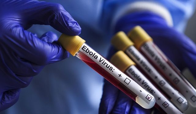 ABD, Ebola salgını nedeniyle Kongo Demokratik Cumhuriyeti'ndeki vatandaşlarının ülkeye dönüşünü kısıtladı