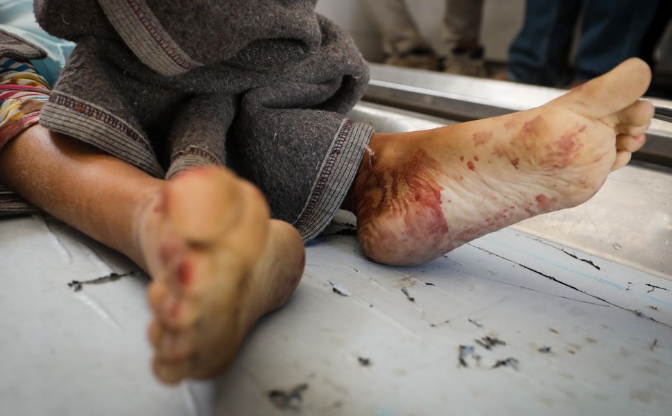 İsrail'in Gazze'ye düzenlediği yoğun saldırılarda biri kadın, ikisi çocuk 3 kişi hayatını kaybetti