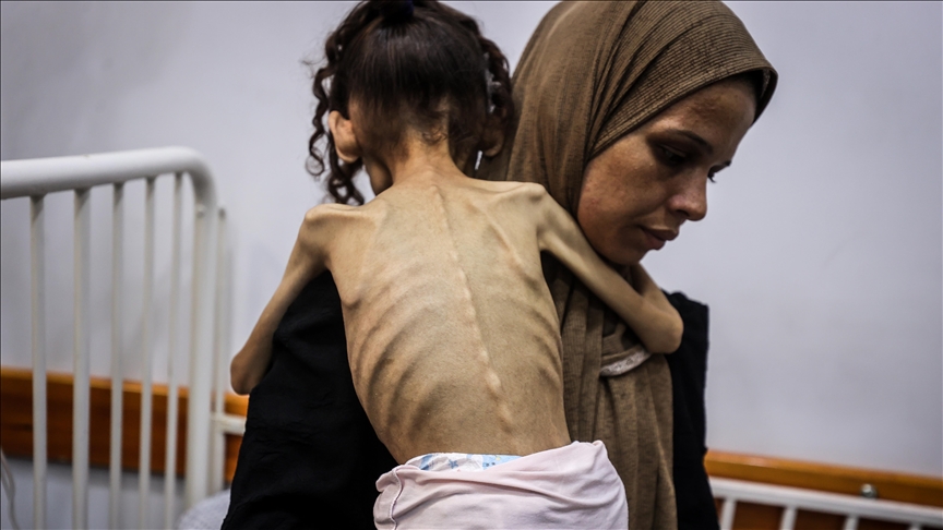 9 yaşındaki Meryem, 25 kilodan 10 kiloya düştü