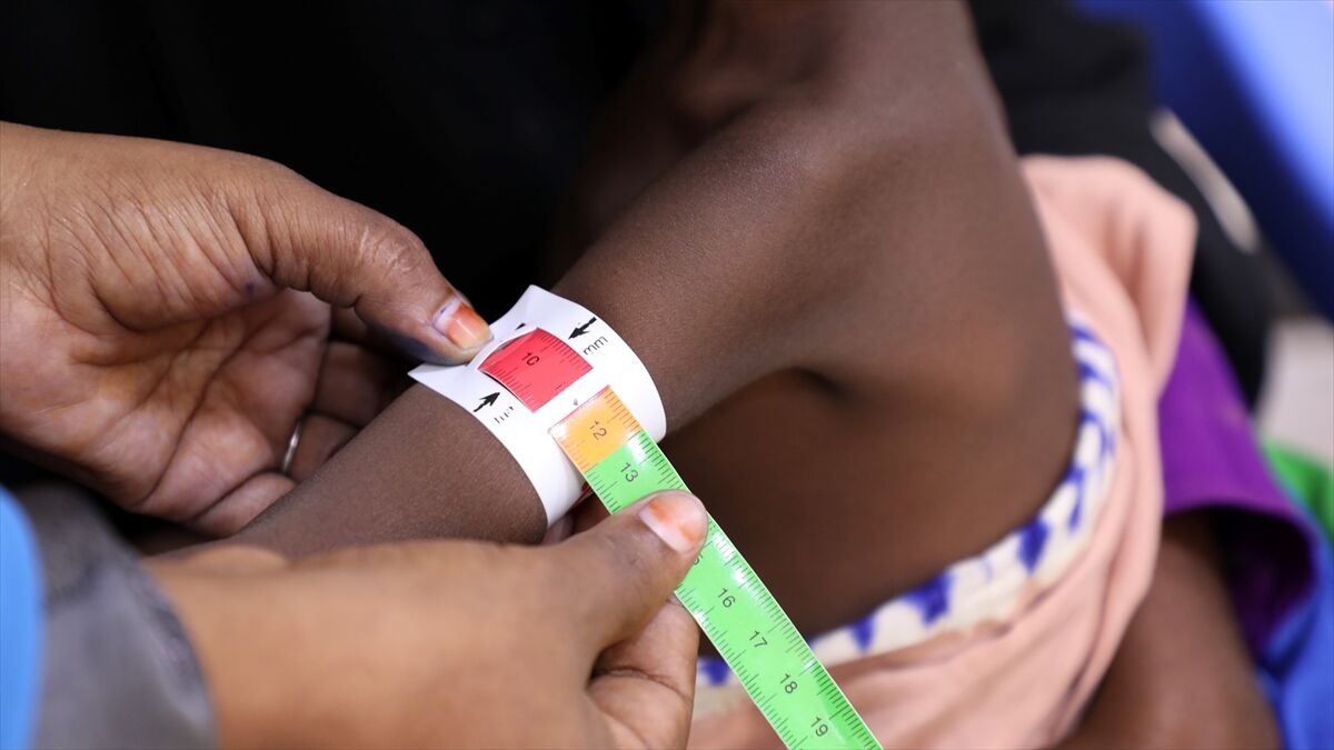 UNICEF, insani yardımların kesildiği Somali'de en büyük bedeli çocukların ödediğini bildirdi